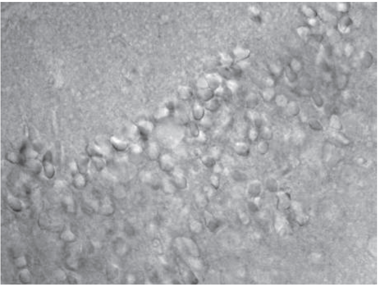小鼠急性脑切片显微图像