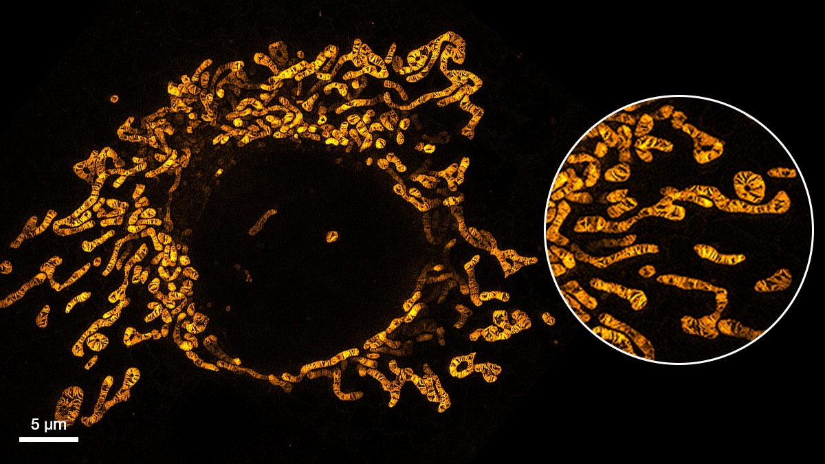 超分辨探针示例图