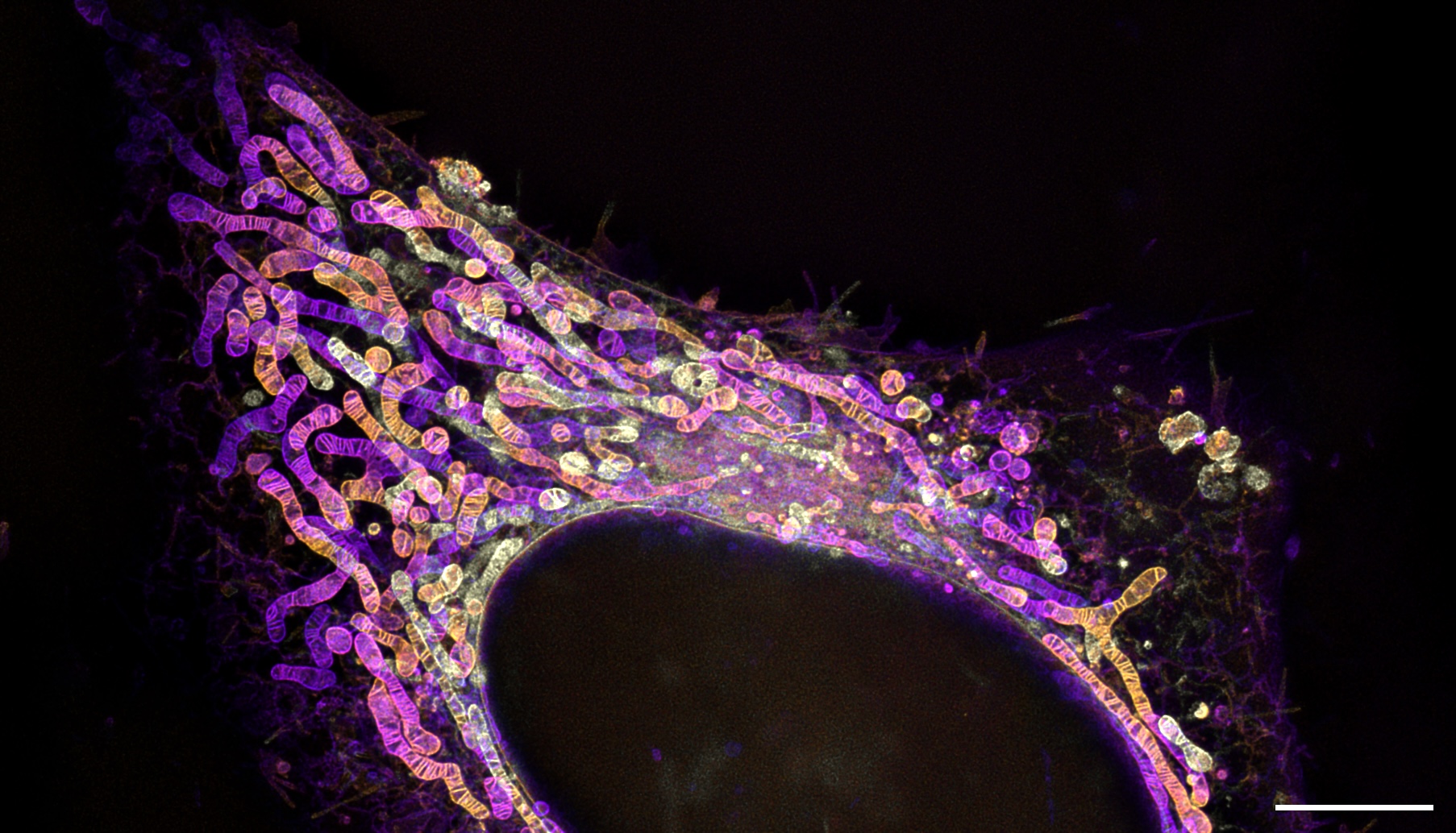 线粒体探针示例图