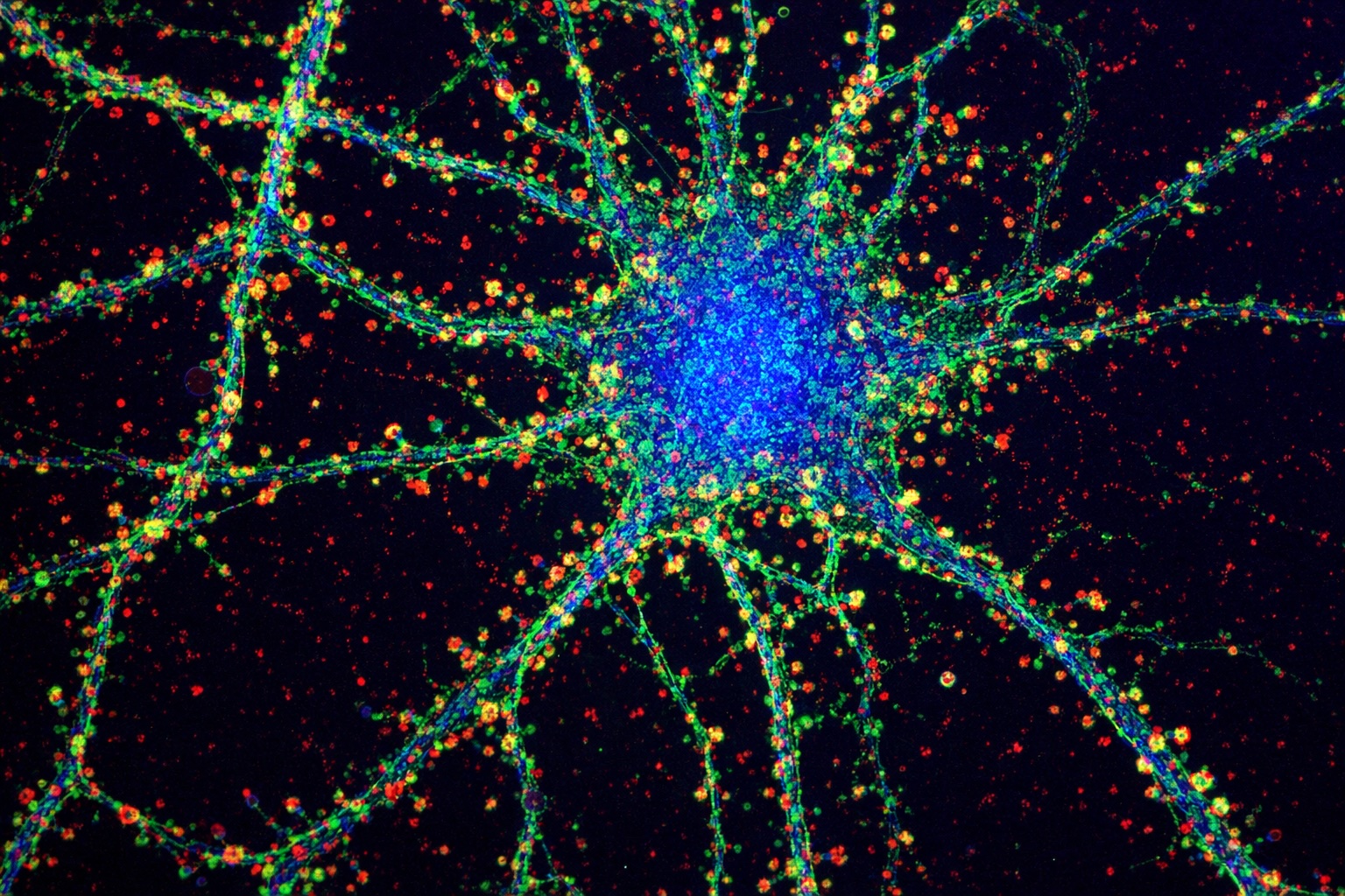 Neuronal calcium imaging
