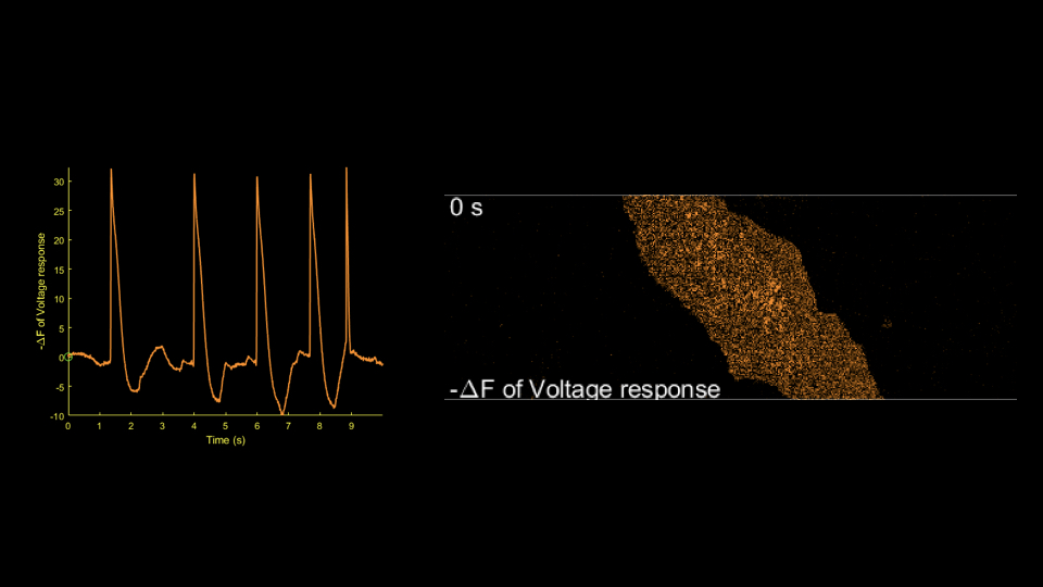 Cardiac voltage imaging